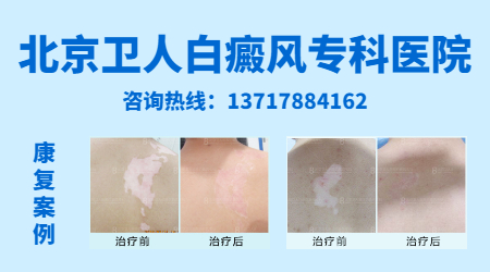 北京白癜风治疗价格揭秘，小巷深处的秘密小店