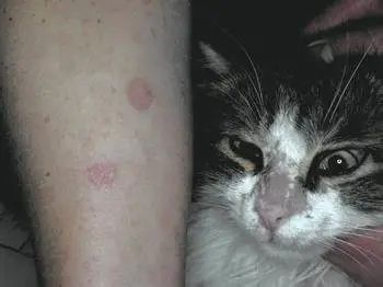 女子频繁逛猫咖染宠物癣，一个月八次遭遇皮肤危机